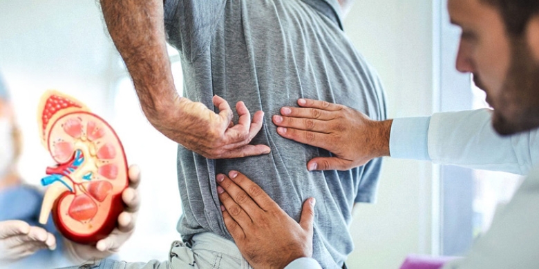 কিডনিতে পাথর হওয়ার কারণ ও লক্ষণ, বাঁচতে যা করবেন