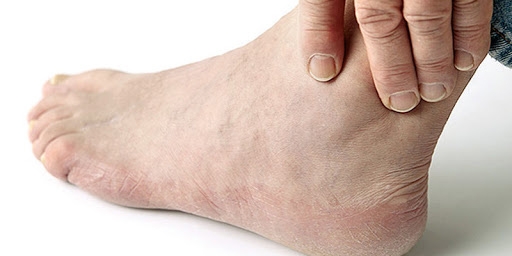 ডায়াবেটিসে পায়ের যত্ন