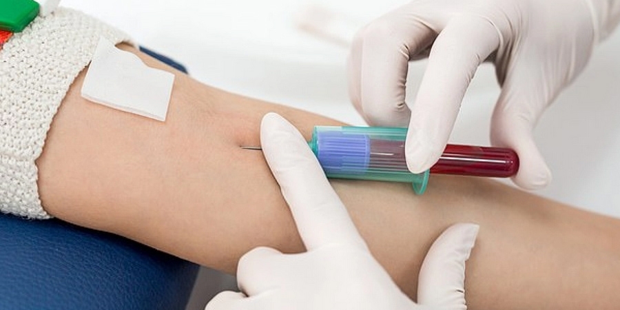 করোনা চিকিৎসায় দেশেও শুরু হলো প্লাজমা থেরাপি