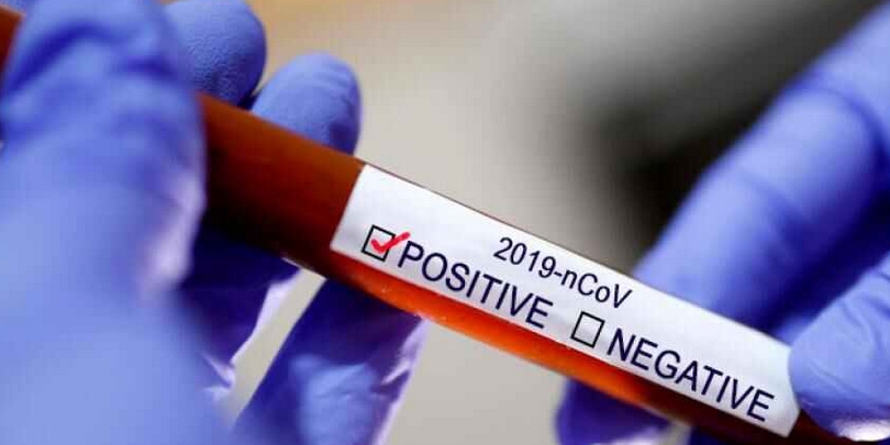 করোনায় সর্বোচ্চ পরীক্ষায় সর্বোচ্চ শনাক্ত, মৃত্যু ১ হাজার ছাড়াল