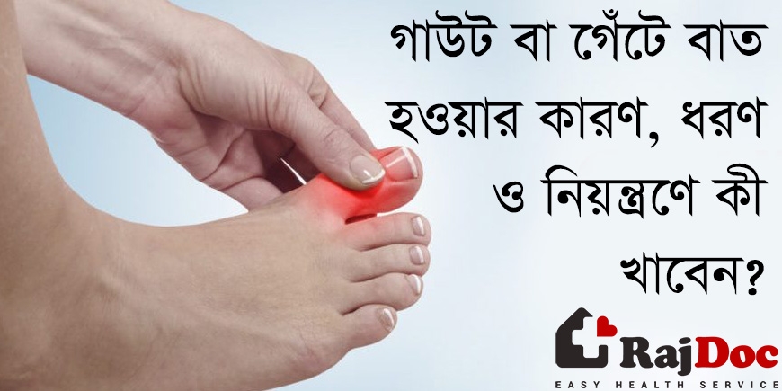 গাউট বা গেঁটে বাত হওয়ার কারণ, ধরণ ও নিয়ন্ত্রণে কী খাবেন?