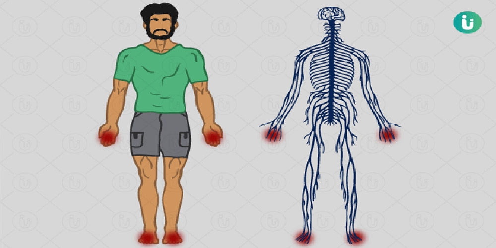 পেরিফেরাল নিউরোপ্যাথি কি?