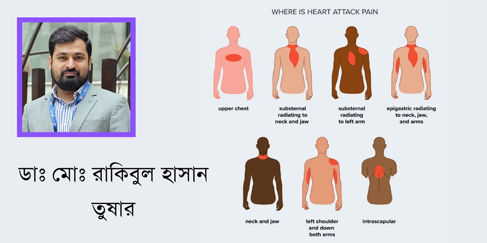 হৃদরোগ জনিত বুকে ব্যথা। ডাঃ মোঃ রাকিবুল হাসান তুষার। এমবিবিএস (রামেক) বিসিএস (স্বাস্থ্য) এমডি (কার্ডিওলজি -হার্ট ফাউন্ডেশন) এমএসিসি (আমেরিকা)
