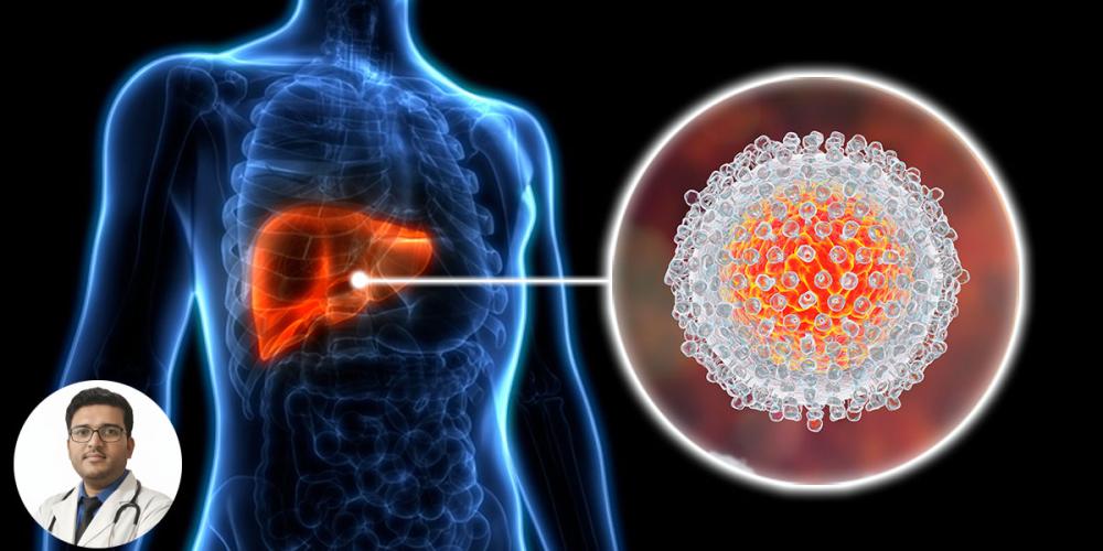 হেপাটাইটিস বি (Hepatitis B): নীরব হলেও অত্যন্ত ঝুঁকিপূর্ণ লিভারের রোগ