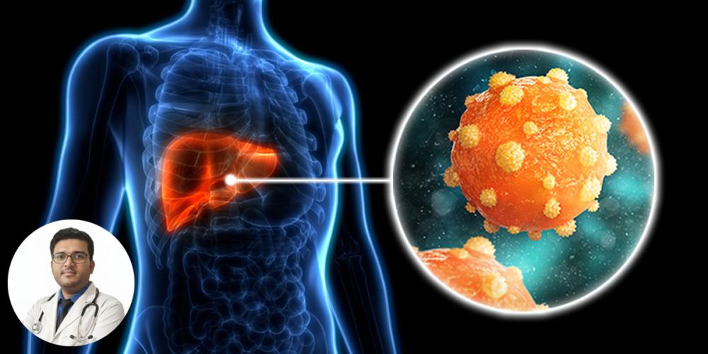 হেপাটাইটিস সি (Hepatitis C): লিভারের নীরব ঘাতক