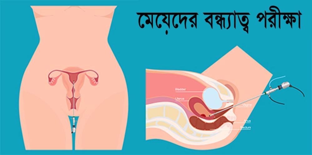 মেয়েদের বন্ধ্যাত্ব পরীক্ষা: জরায়ু ও হরমোনের কী কী টেস্ট করতে হয় এবং কেন?