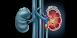 মেয়েদের কিডনি ও কিডনির নালির পাথর বেশি হওয়ার কারন?