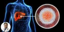 হেপাটাইটিস বি (Hepatitis B): নীরব হলেও অত্যন্ত ঝুঁকিপূর্ণ লিভারের রোগ