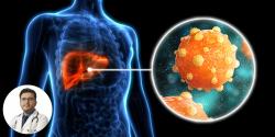 হেপাটাইটিস সি (Hepatitis C): লিভারের নীরব ঘাতক