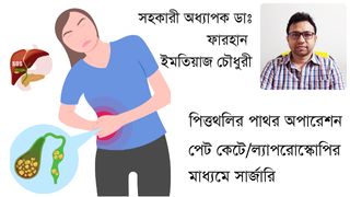 পিত্তথলির পাথর অপারেশন। পেট কেটে এবং ল্যাপরোস্কোপিক সার্জারীর মাধ্যমে। Surgery Doctor in Rajshahi