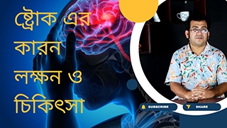 স্ট্রোকের কারণ, লক্ষণ ও ঝুঁকি এড়ানোর উপায়। Stroke Symptoms. RajDoc.com